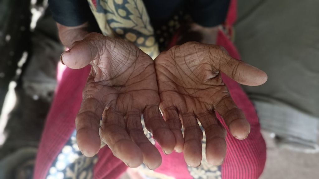 The People We Support